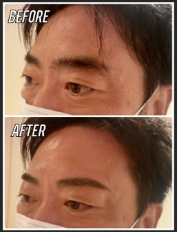 メンズ眉毛サロン 代官山・中目黒・恵比寿本店眉スタイリングBefore After2