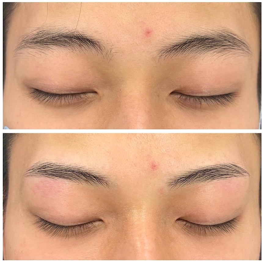メンズ眉毛サロン BROWS 新橋店眉スタイリングBefore After2