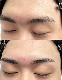  i.b眉スタイリングBefore After1