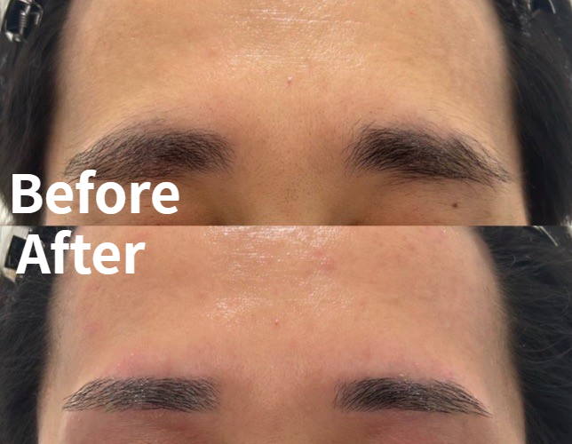 眉毛の王様眉スタイリングBefore After2