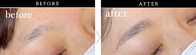 ZA/ZA エステティックスパbeforeafter