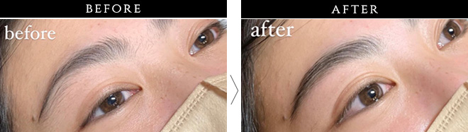 ZA/ZA エステティックスパbeforeafter